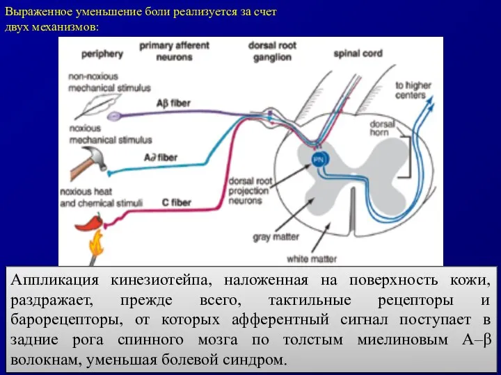 Выраженное уменьшение боли реализуется за счет двух механизмов: Аппликация кинезиотейпа, наложенная