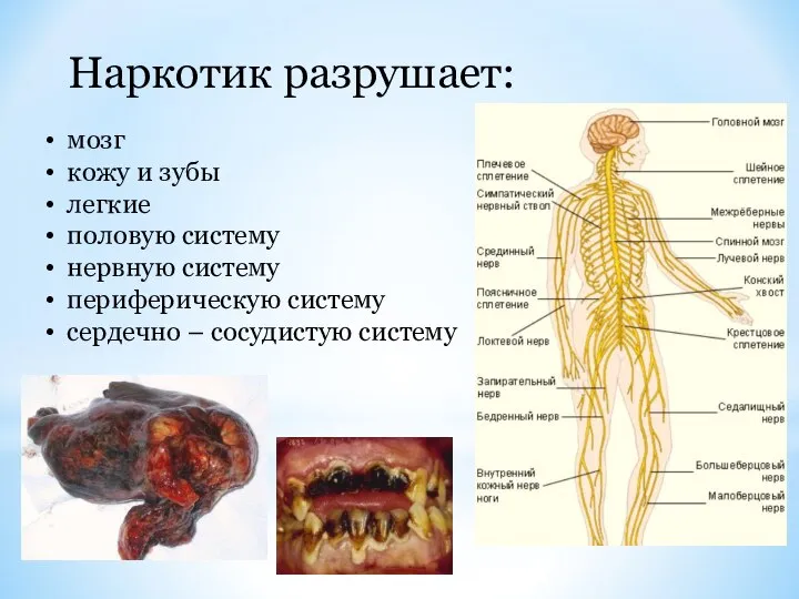 Наркотик разрушает: мозг кожу и зубы легкие половую систему нервную систему