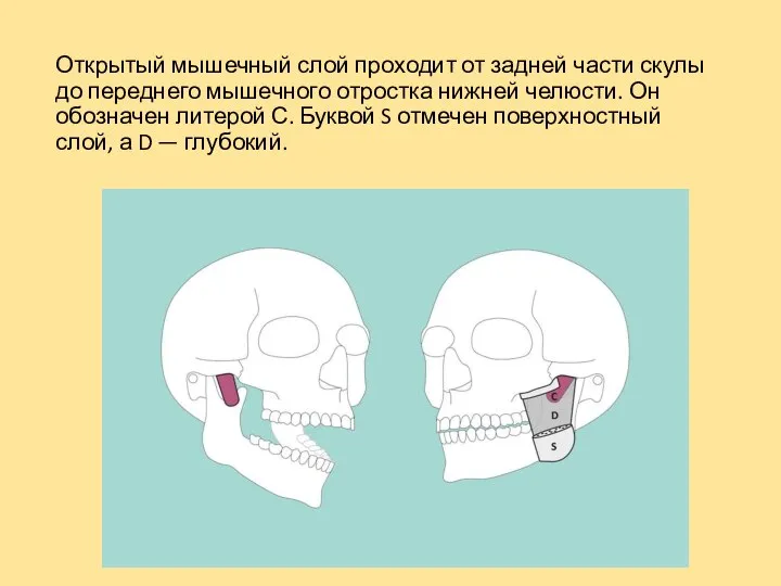 Открытый мышечный слой проходит от задней части скулы до переднего мышечного