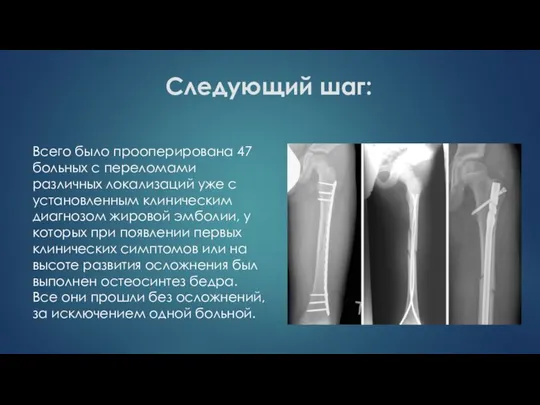 Следующий шаг: Всего было прооперирована 47 больных с переломами различных локализаций