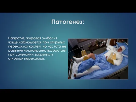 Патогенез: Напротив, жировая эмболия чаще наблюдается при открытых переломах костей, но