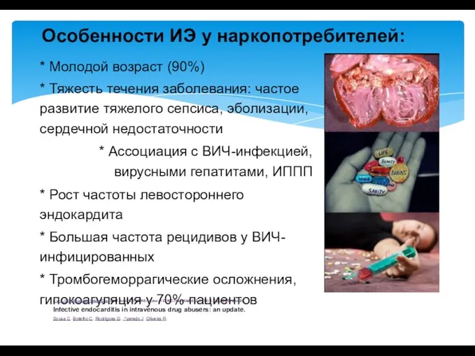 Особенности ИЭ у наркопотребителей: * Молодой возраст (90%) * Тяжесть течения