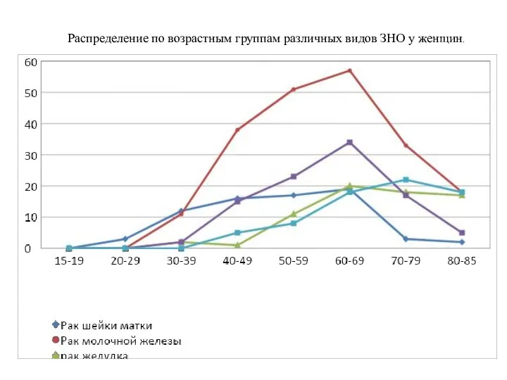 Распределение по возрастным группам различных видов ЗНО у женщин.