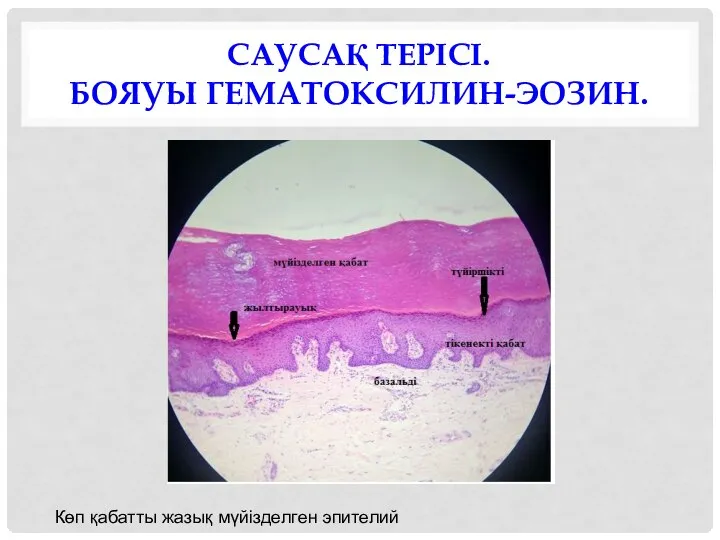 САУСАҚ ТЕРІСІ. БОЯУЫ ГЕМАТОКСИЛИН-ЭОЗИН. Көп қабатты жазық мүйізделген эпителий