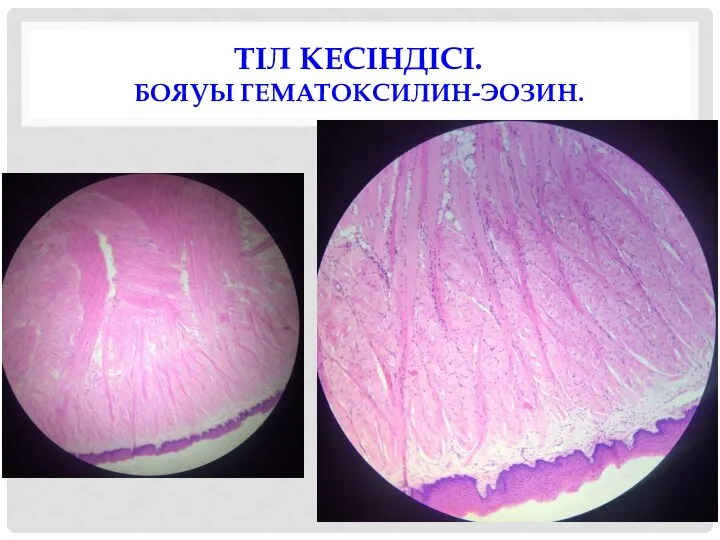 ТІЛ КЕСІНДІСІ. БОЯУЫ ГЕМАТОКСИЛИН-ЭОЗИН.