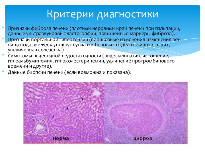 Признаки фиброза печени (плотный неровный край печени при пальпации, данные ультразвуковой