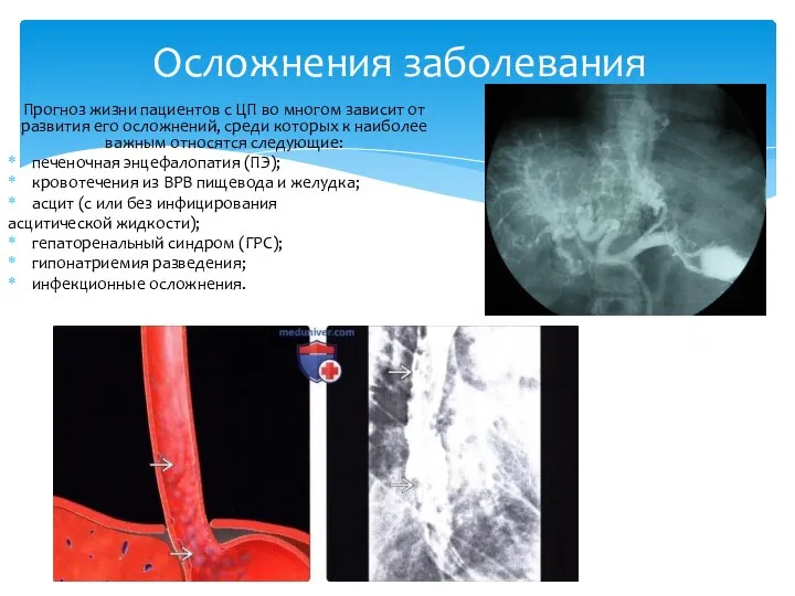 Прогноз жизни пациентов с ЦП во многом зависит от развития его