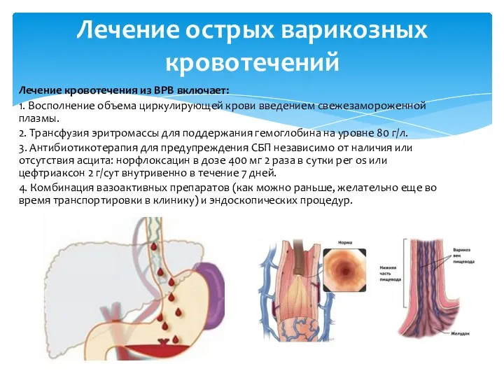 Лечение кровотечения из ВРВ включает: 1. Восполнение объема циркулирующей крови введением