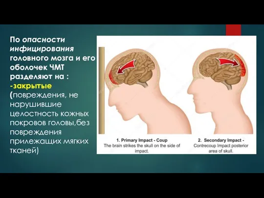 По опасности инфицирования головного мозга и его оболочек ЧМТ разделяют на