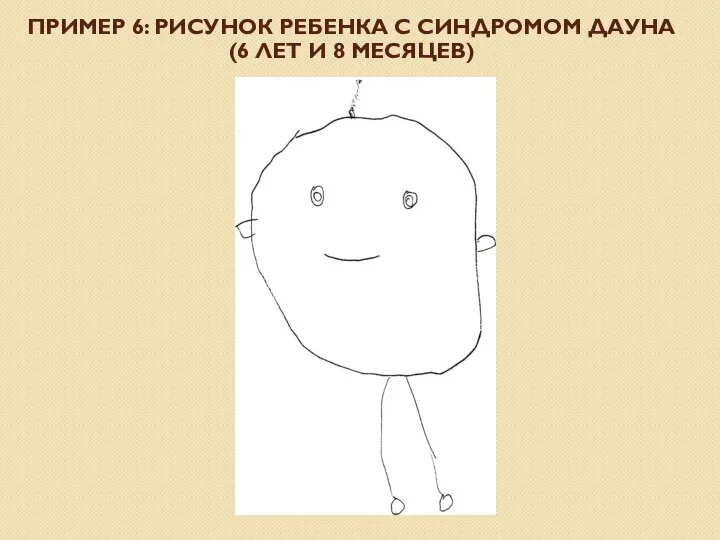 ПРИМЕР 6: РИСУНОК РЕБЕНКА С СИНДРОМОМ ДАУНА (6 ЛЕТ И 8 МЕСЯЦЕВ)