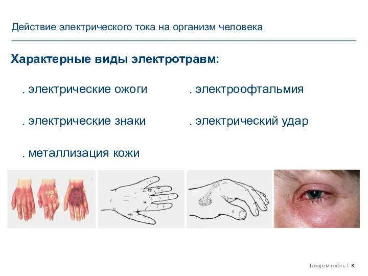 Действие электрического тока на организм человека Характерные виды электротравм: . электрические