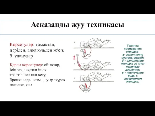 Асқазанды жуу техникасы Көрсетулер: тамақтан, дәріден, алкагольден ж/е т.б. уланулар Қарсы