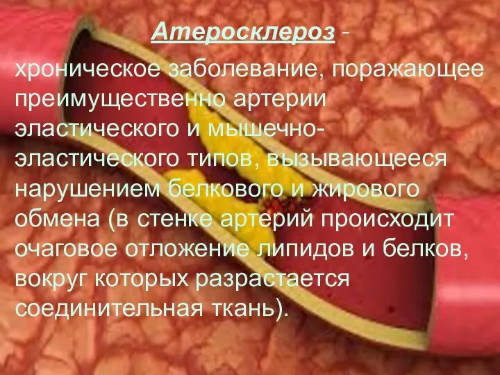 Атеросклероз - хроническое заболевание, поражающее преимущественно артерии эластического и мышечно-эластического типов,