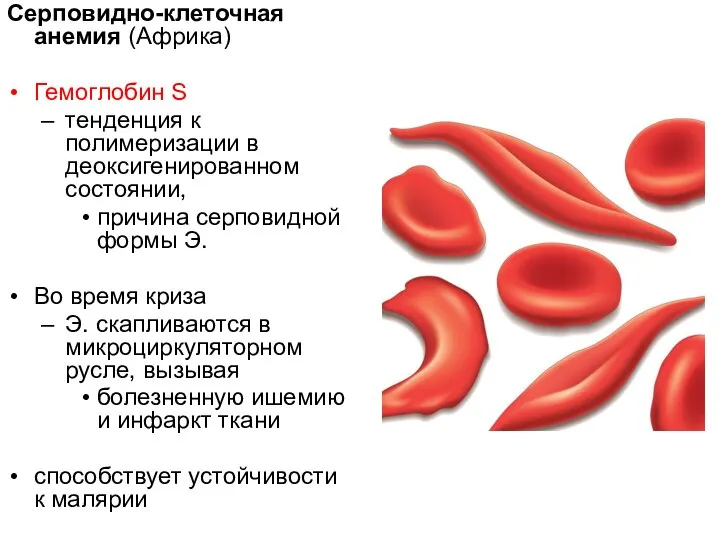 Серповидно-клеточная анемия (Африка) Гемоглобин S тенденция к полимеризации в деоксигенированном состоянии,