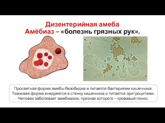 Дизентерийная амеба Амёбиаз – «болезнь грязных рук». Просветная форма амебы безобидна