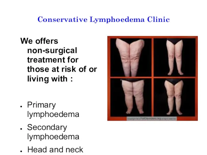 Conservative Lymphoedema Clinic We offers non-surgical treatment for those at risk