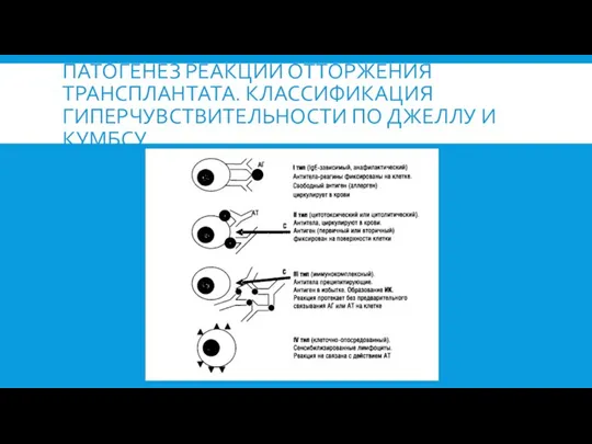 ПАТОГЕНЕЗ РЕАКЦИЙ ОТТОРЖЕНИЯ ТРАНСПЛАНТАТА. КЛАССИФИКАЦИЯ ГИПЕРЧУВСТВИТЕЛЬНОСТИ ПО ДЖЕЛЛУ И КУМБСУ.