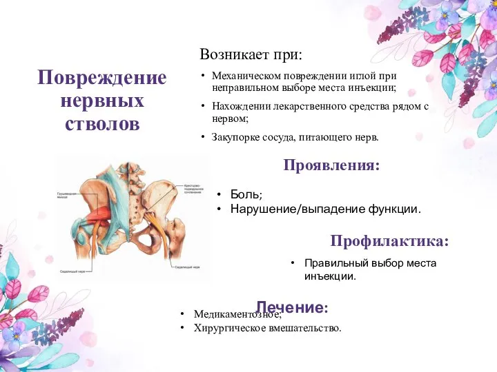 Повреждение нервных стволов Возникает при: Механическом повреждении иглой при неправильном выборе