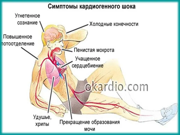 Цвет кожных покровов (бледная, мраморная, цианоз); Температура тела (понижена, липкий холодный