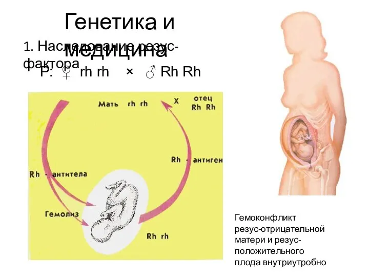 Генетика и медицина 1. Наследование резус-фактора P: ♀ rh rh ×