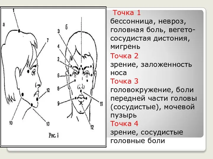 Точка 1 бессонница, невроз, головная боль, вегето-сосудистая дистония, мигрень Точка 2