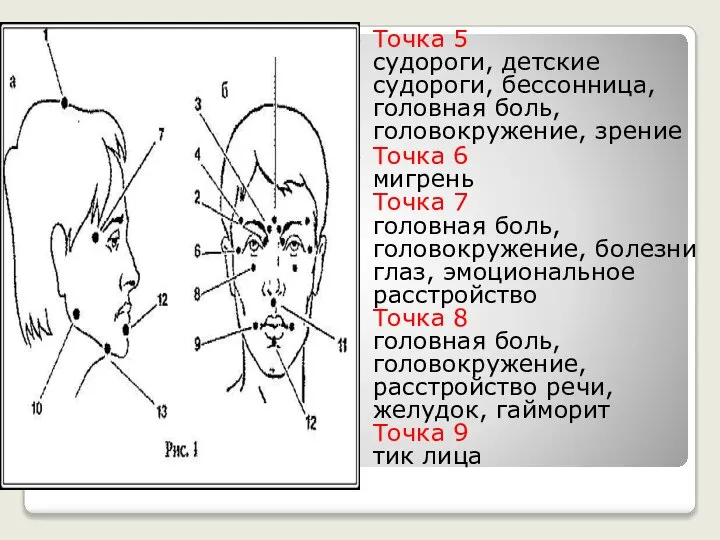 Точка 5 судороги, детские судороги, бессонница, головная боль, головокружение, зрение Точка