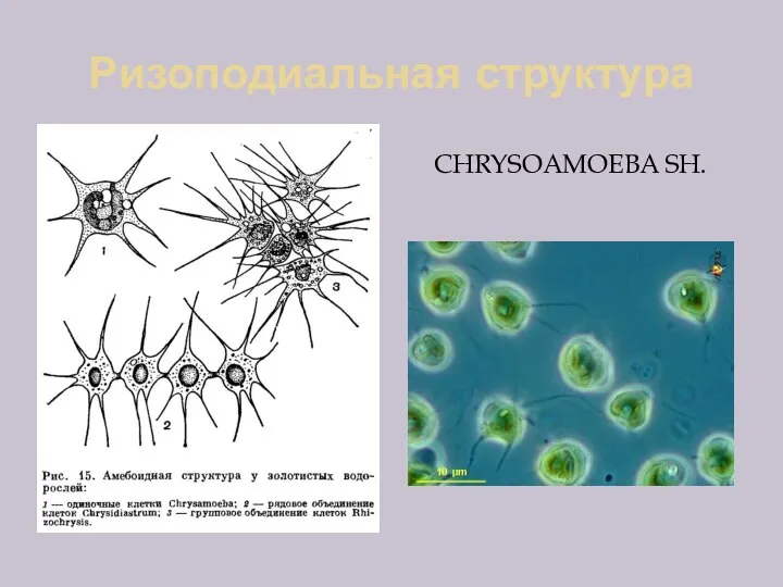 Ризоподиальная структура CHRYSOAMOEBA SH.