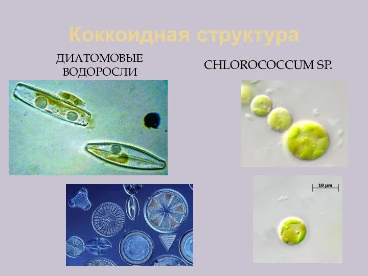 Коккоидная структура ДИАТОМОВЫЕ ВОДОРОСЛИ CHLOROCOCCUM SP.