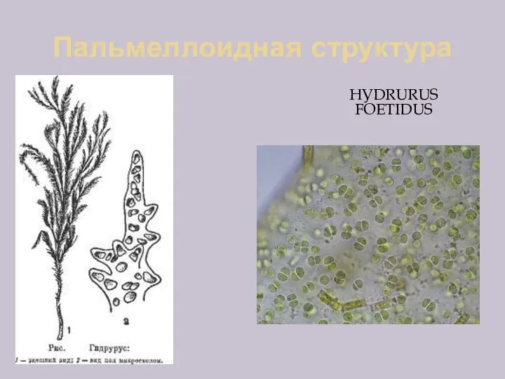 Пальмеллоидная структура НУDRURUS FOETIDUS