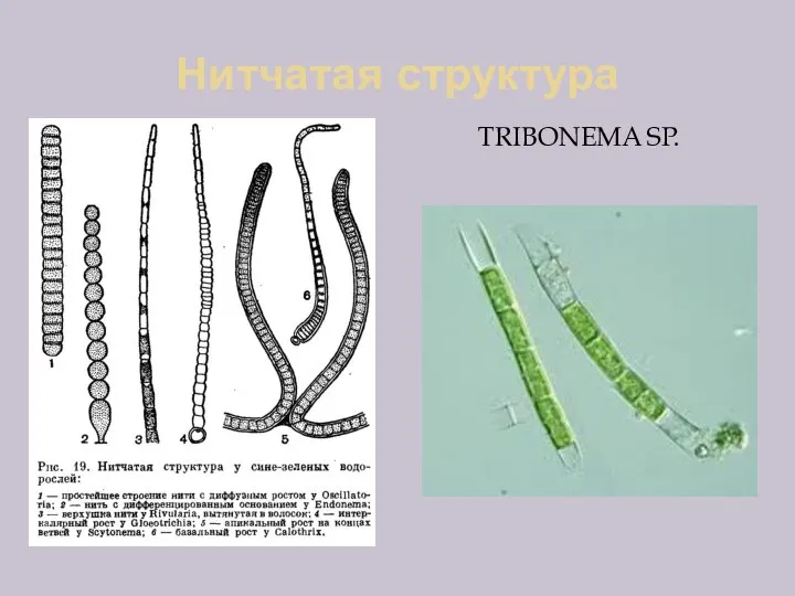 Нитчатая структура TRIBONEMA SP.