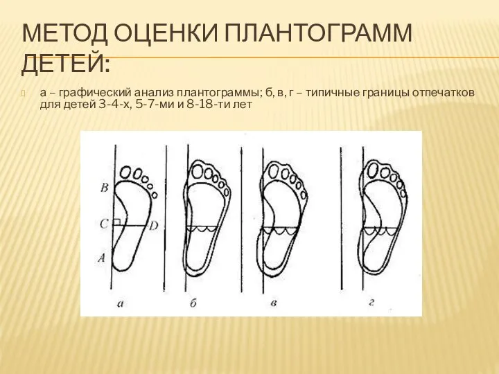 МЕТОД ОЦЕНКИ ПЛАНТОГРАММ ДЕТЕЙ: а – графический анализ плантограммы; б, в,