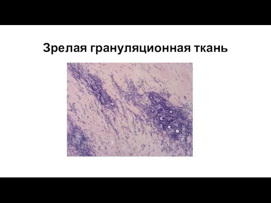 Зрелая грануляционная ткань