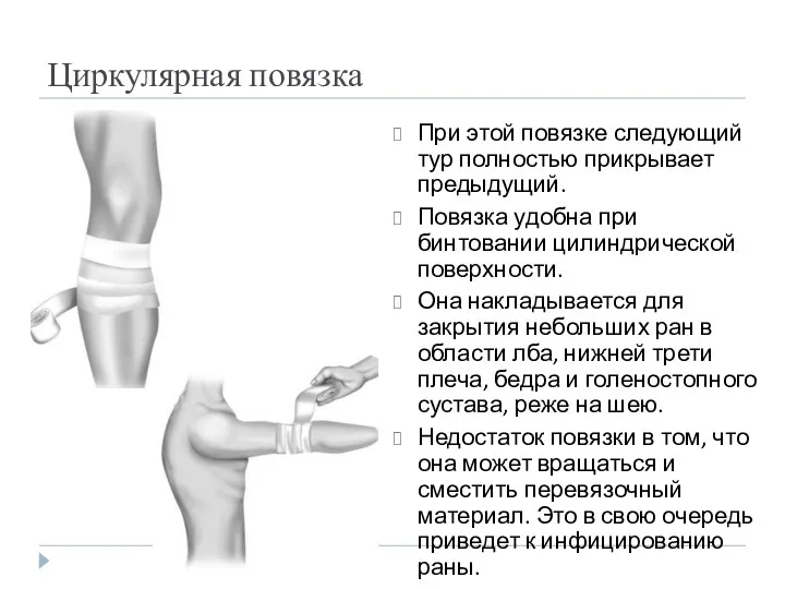 Циркулярная повязка При этой повязке следующий тур полностью прикрывает предыдущий. Повязка