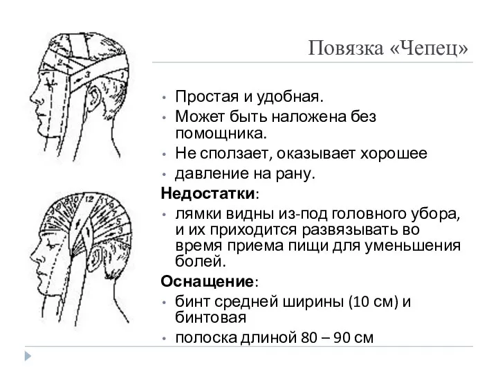 Повязка «Чепец» Простая и удобная. Может быть наложена без помощника. Не