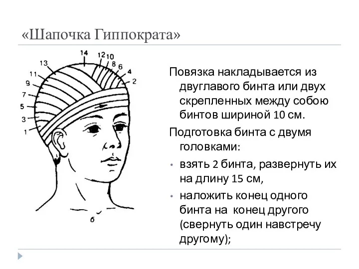 «Шапочка Гиппократа» Повязка накладывается из двуглавого бинта или двух скрепленных между