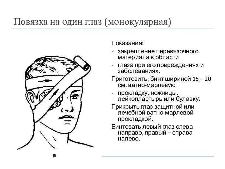 Повязка на один глаз (монокулярная) Показания: закрепление перевязочного материала в области