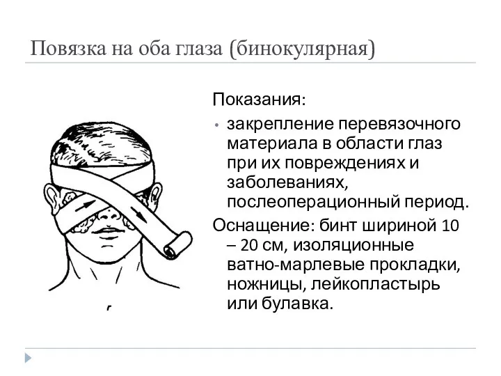 Повязка на оба глаза (бинокулярная) Показания: закрепление перевязочного материала в области