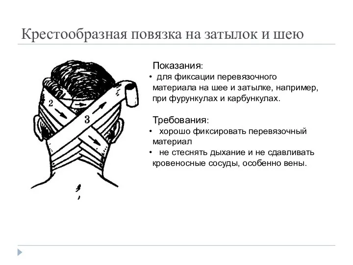 Крестообразная повязка на затылок и шею Показания: для фиксации перевязочного материала