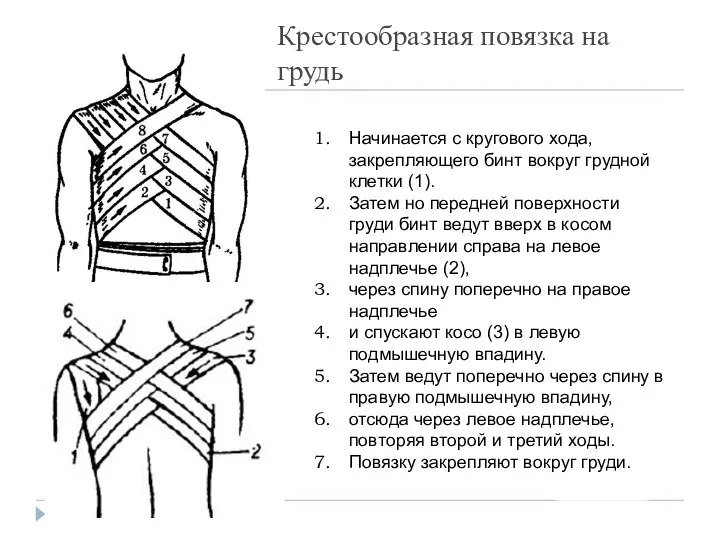 Крестообразная повязка на грудь Начинается с кругового хода, закрепляющего бинт вокруг