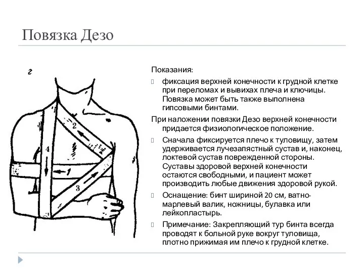 Повязка Дезо Показания: фиксация верхней конечности к грудной клетке при переломах