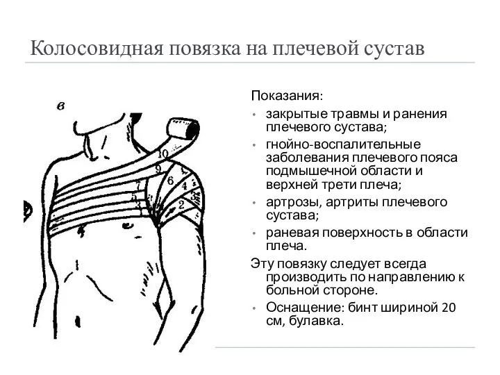 Колосовидная повязка на плечевой сустав Показания: закрытые травмы и ранения плечевого