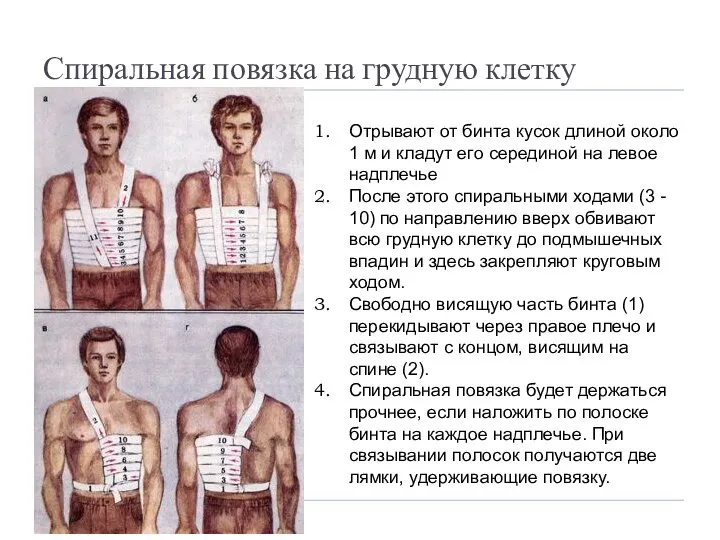 Спиральная повязка на грудную клетку Отрывают от бинта кусок длиной около