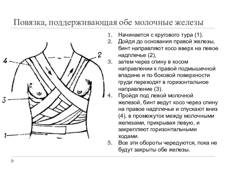 Повязка, поддерживающая обе молочные железы Начинается с кругового тура (1). Дойдя