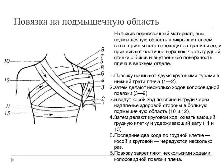 Повязка на подмышечную область Наложив перевязочный материал, всю подмышечную область прикрывают