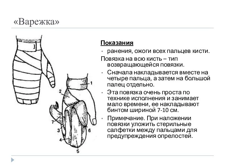 «Варежка» Показания ранения, ожоги всех пальцев кисти. Повязка на всю кисть