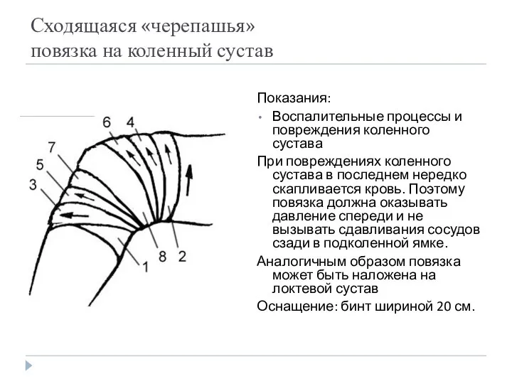 Сходящаяся «черепашья» повязка на коленный сустав Показания: Воспалительные процессы и повреждения