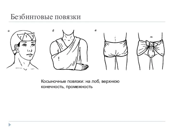 Безбинтовые повязки Косыночные повязки: на лоб, верхнюю конечность, промежность