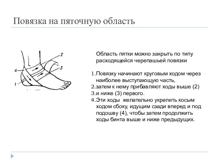 Повязка на пяточную область Область пятки можно закрыть по типу расходящейся