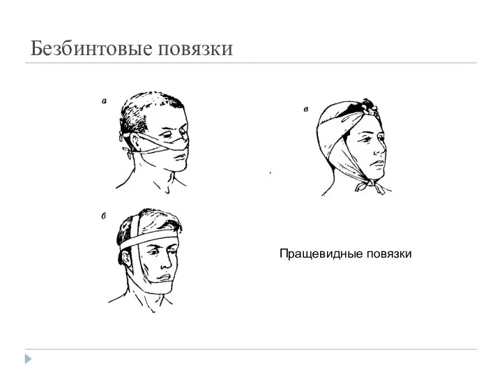 Безбинтовые повязки Пращевидные повязки