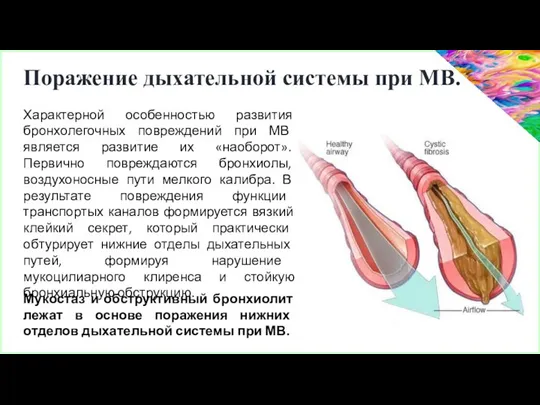 Характерной особенностью развития бронхолегочных повреждений при МВ является развитие их «наоборот».